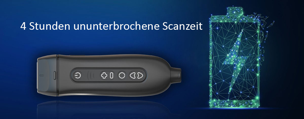 endocon Diagnostics Q7 Mobiles Ultraschallgerät Pocket System 4 Stunden Scanzeit Youkey Q7 endocon Diagnostics Q7 Mobiles Ultraschallgerät Pocket System 4 Stunden Scanzeit Youkey Q7